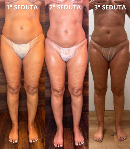 ✨ Metodo Evolvè: il modellamento trasformativo corpo a Milano